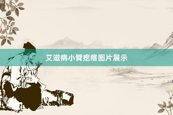 艾滋病小臂疙瘩图片展示